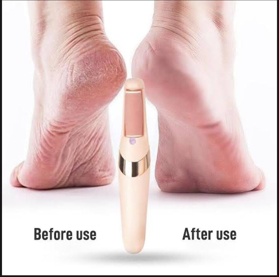 Rechargeable Electric Pedi Foot Filer – Callus Remover for Soft, Smooth Feet